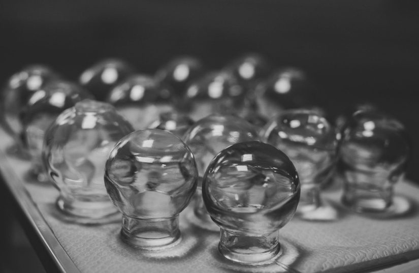 Ostéopathe Ventouse