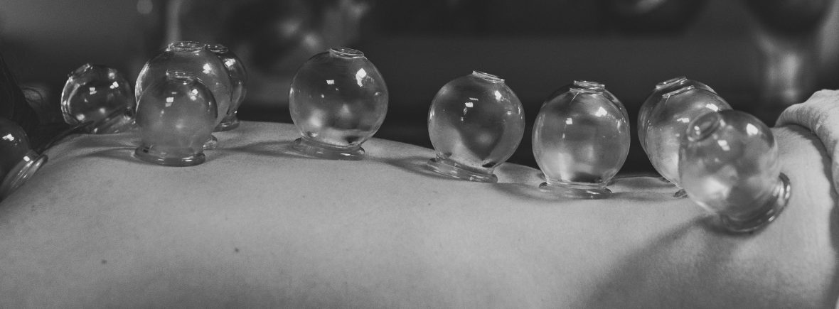 Ostéopathe ventouse