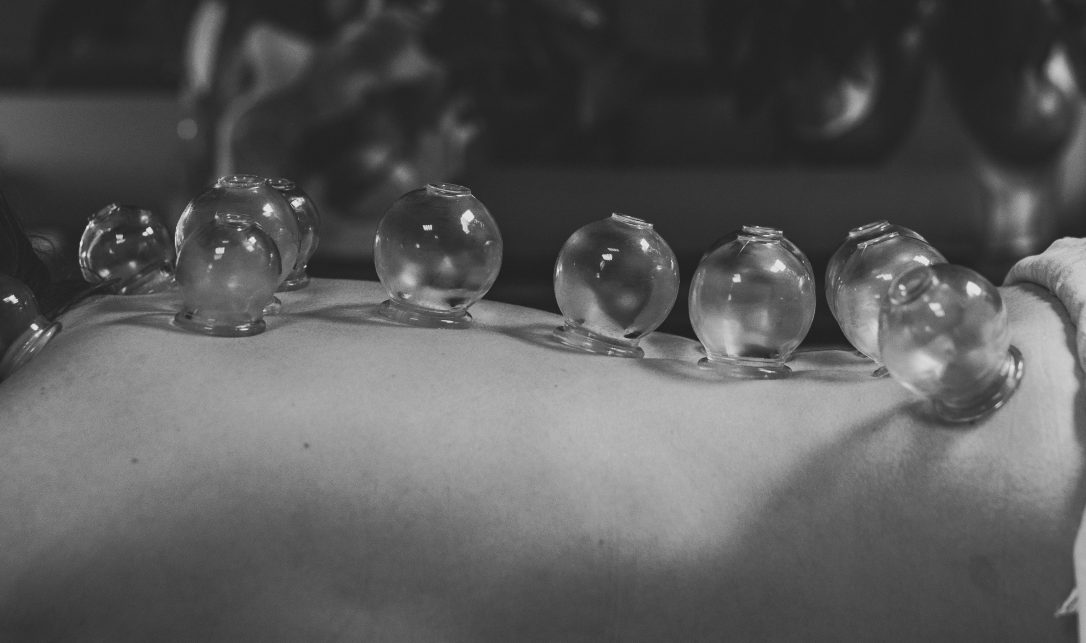 Ostéopathe ventouse