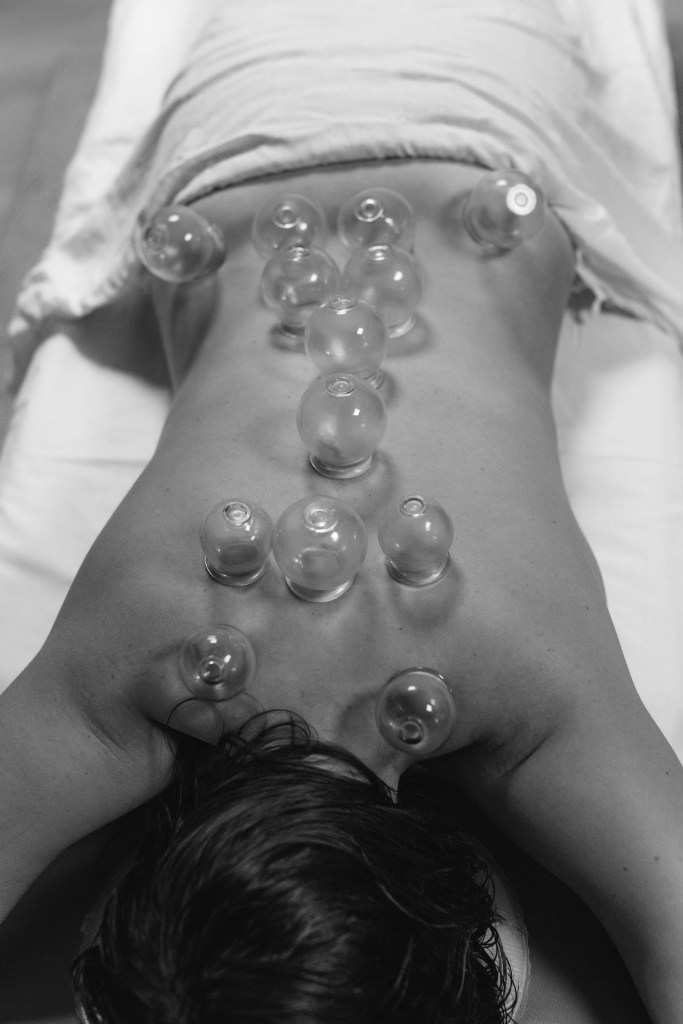 Ostéopathe ventouse